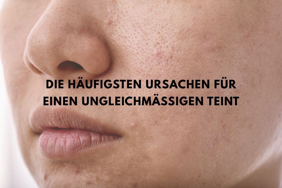 Die häufigsten Ursachen für einen ungleichmäßigen Teint