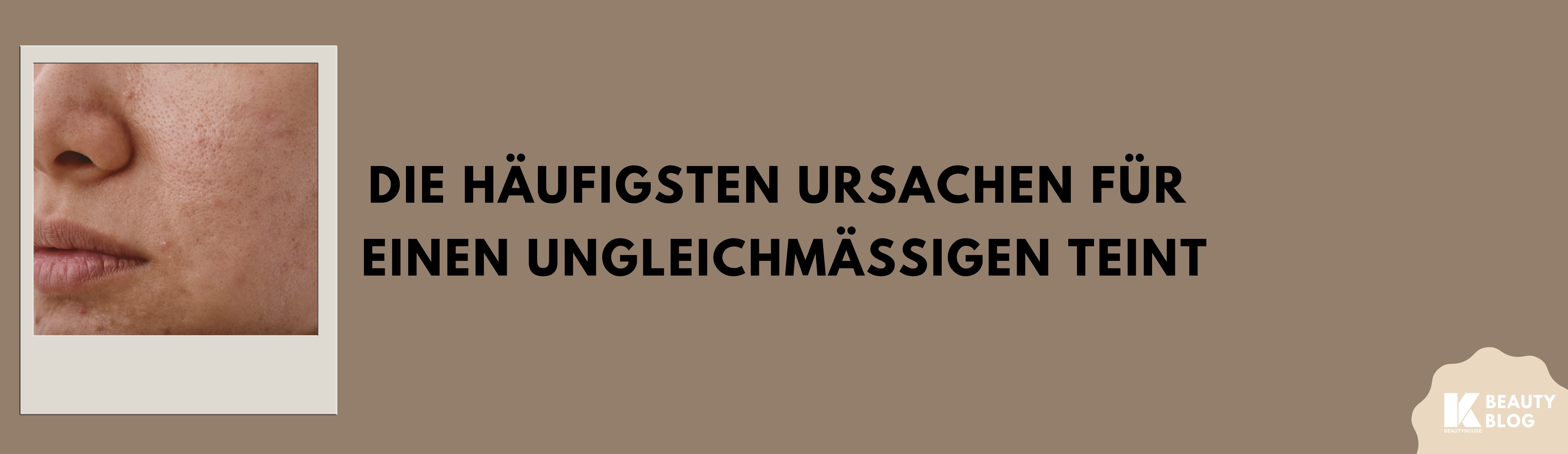 Beitragsbild zum Blogartikel über Sonnenschutz und warum man auch im März täglich SPF verwenden sollte