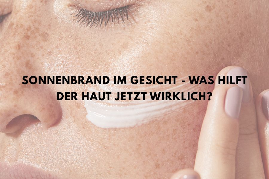 Sonnenbrand im Gesicht - Was hilft jetzt wirklich ?