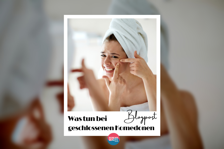 Wie du geschlossene Komedonen verhinderst und deine Hauttextur dadurch verbesserst