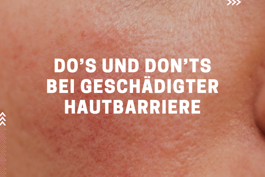 Do’s & Don‘ts bei geschädigter Hautbarriere