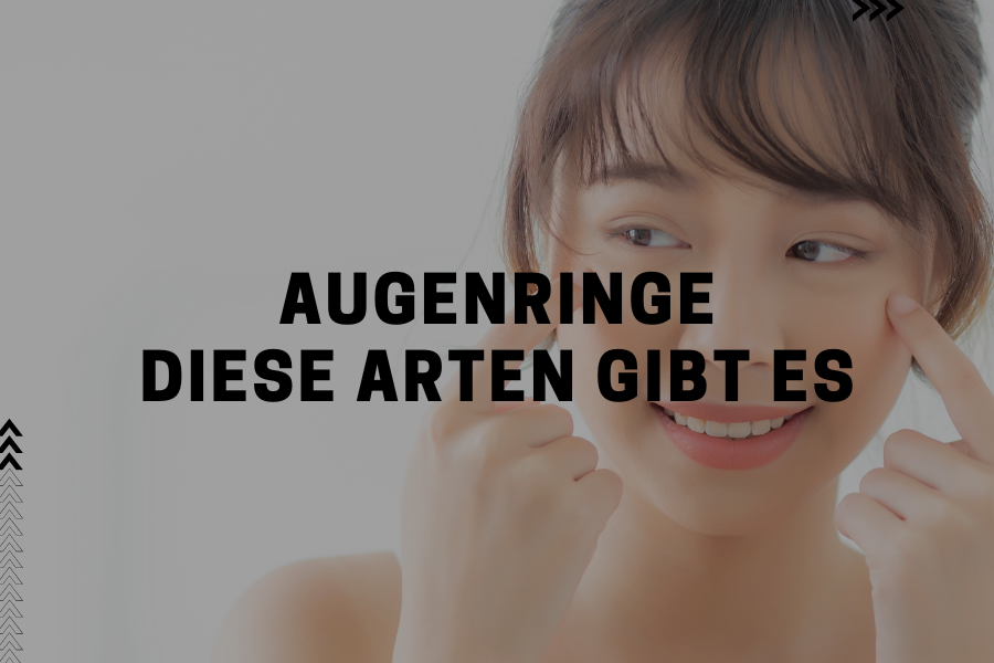 Diese Arten von Augenringen gibt es