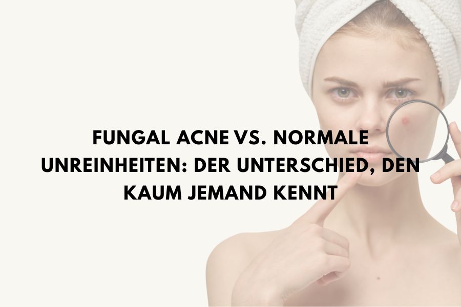 Fungal Acne vs. normale Unreinheiten: Der Unterschied, den kaum jemand kennt